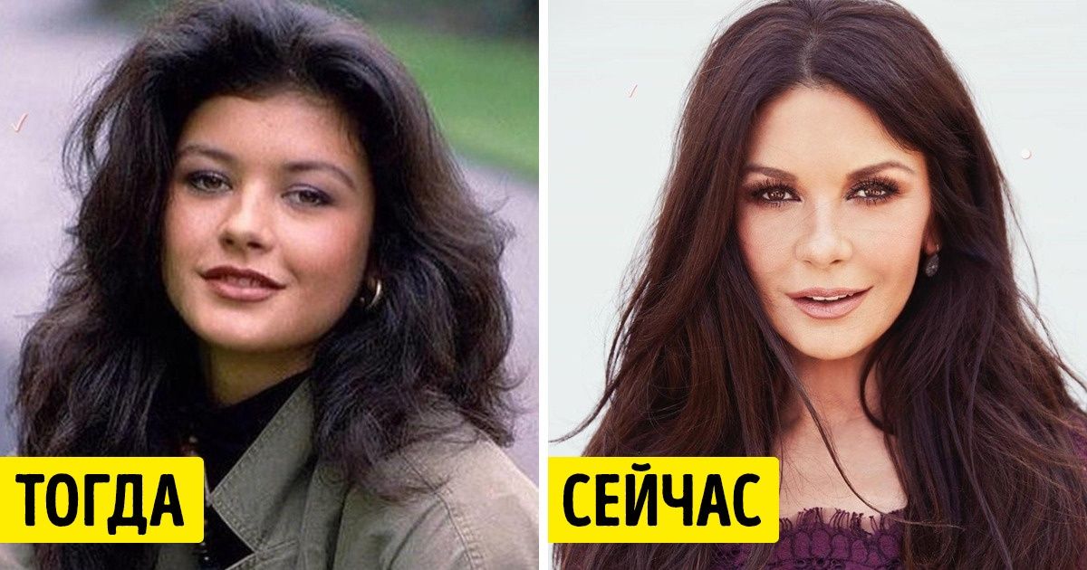 Посмотрите, как выглядели знаменитости до того, как решили поработать над своей внешностью Посмотрите, как выглядели знаменитости до того, как решили поработать над своей внешностью