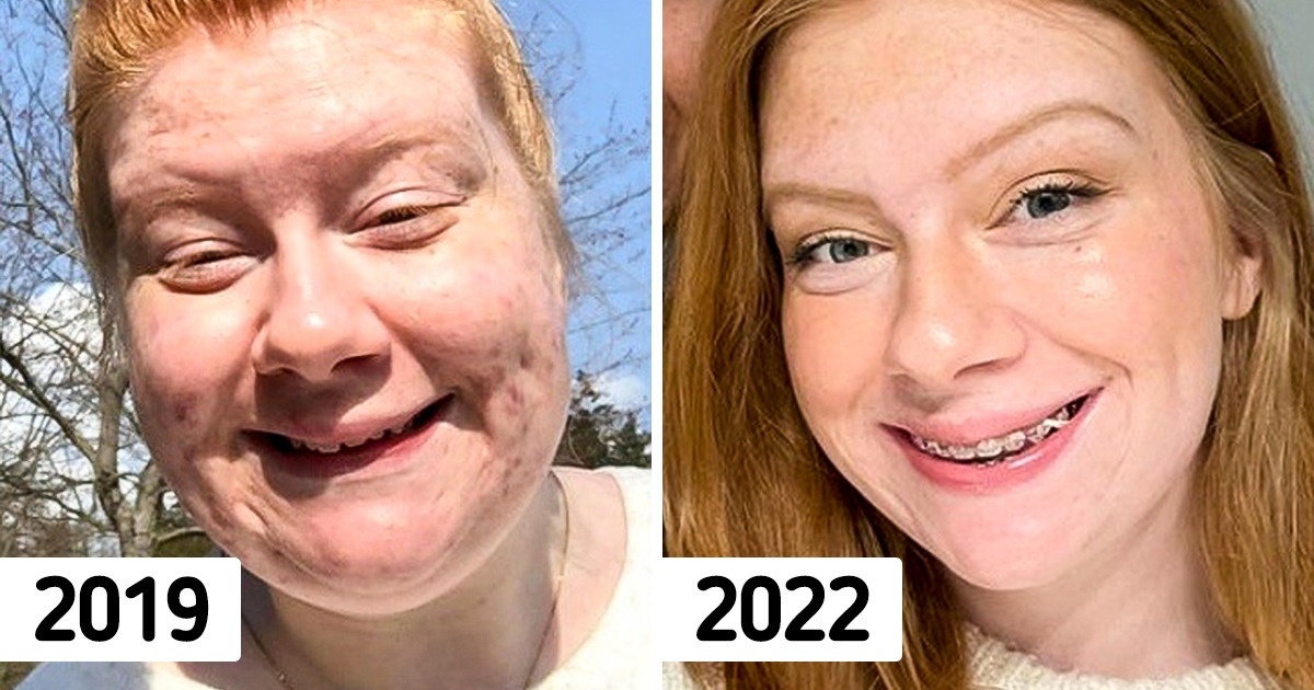 17 человек, которые своим примером отсыплют вам мотивации на годы вперед 17 человек, которые своим примером отсыплют вам мотивации на годы вперед