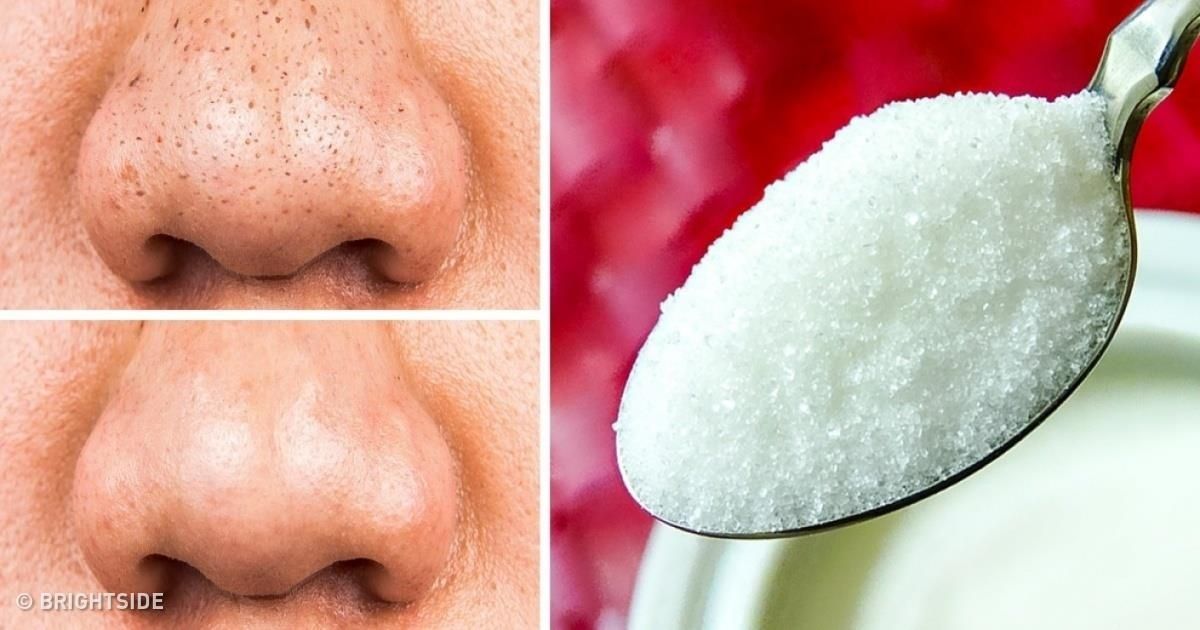 12 натуральных средств, которые помогут сохранить вашу кожу молодой
