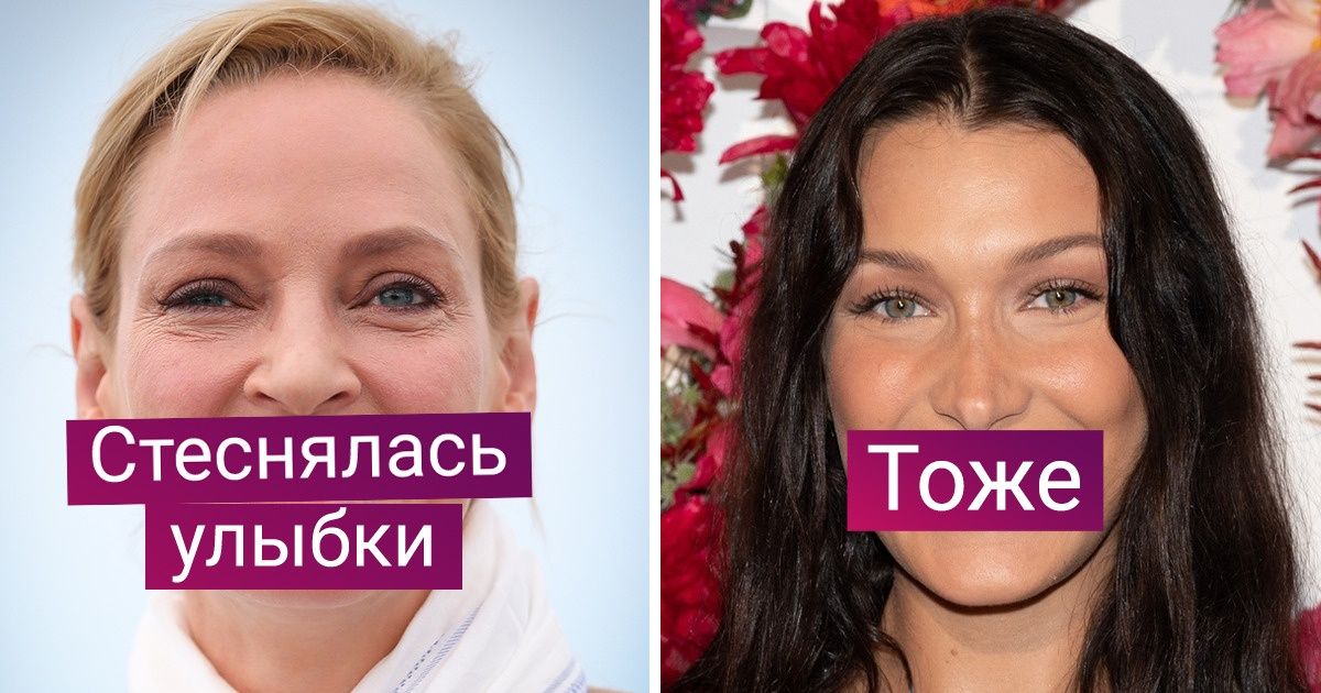 12 звезд, которые редко улыбаются. А мы нашли такие фото и глазам своим не поверили 12 звезд, которые редко улыбаются. А мы нашли такие фото и глазам своим не поверили