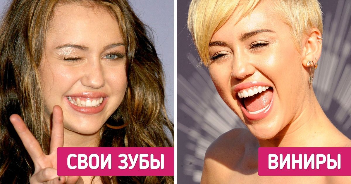 9 примеров модных изменений внешности, последствия которых можно долго расхлебывать