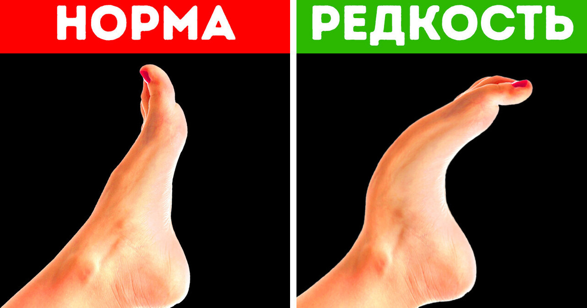 Этой особенностью обладают только 8 % людей + еще 17 редких особенностей тела