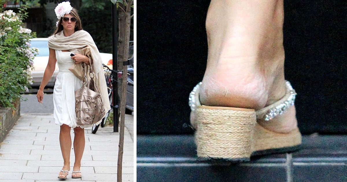 12 крошечных деталей внешности, которые выдают всю подноготную о вас