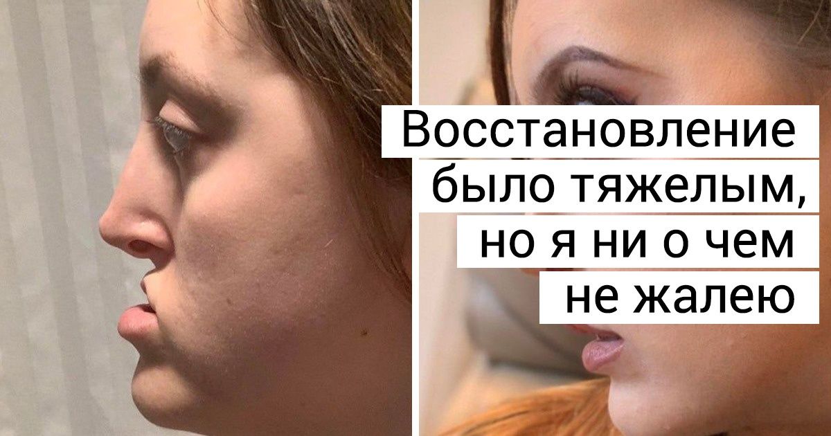 20 человек, которые решились на пластическую операцию и стали выглядеть потрясающе 20 человек, которые решились на пластическую операцию и стали выглядеть потрясающе
