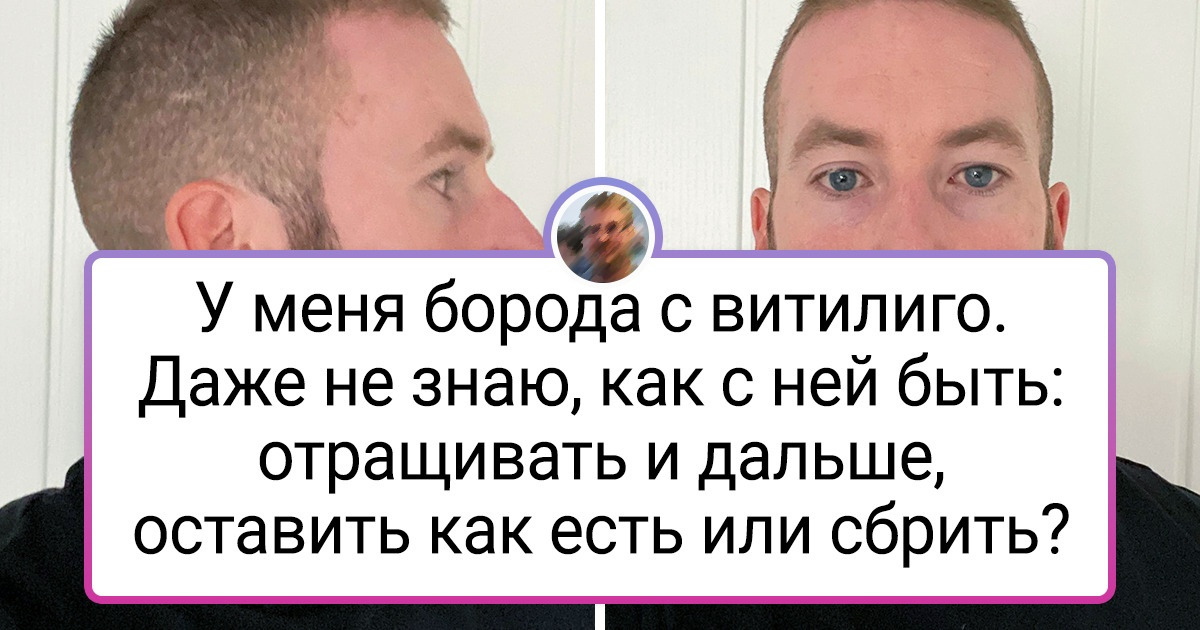 20+ человек, которые без стеснения показали, какую изюминку им подкинула природа