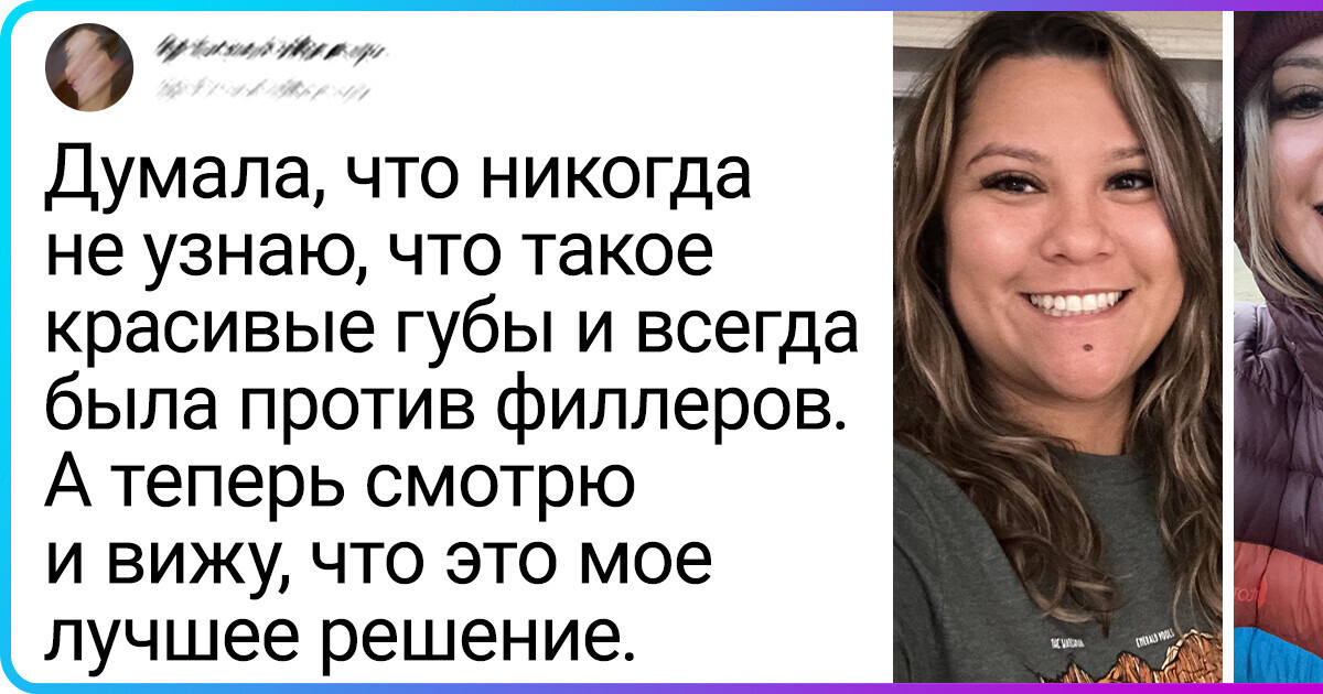 15 фотосравнений, которые и разглядывать долго не надо, чтобы увидеть разницу 15 фотосравнений, которые и разглядывать долго не надо, чтобы увидеть разницу