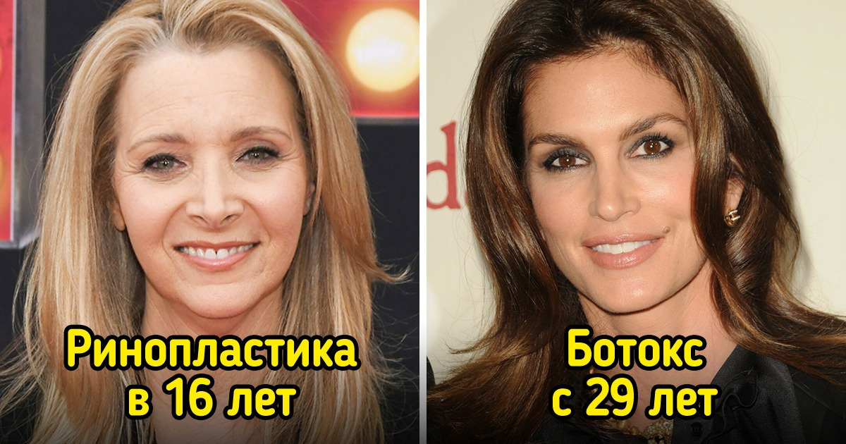 11 звезд, которые решились на пластику и не стали сочинять сказок о генетической лотерее 11 звезд, которые решились на пластику и не стали сочинять сказок о генетической лотерее