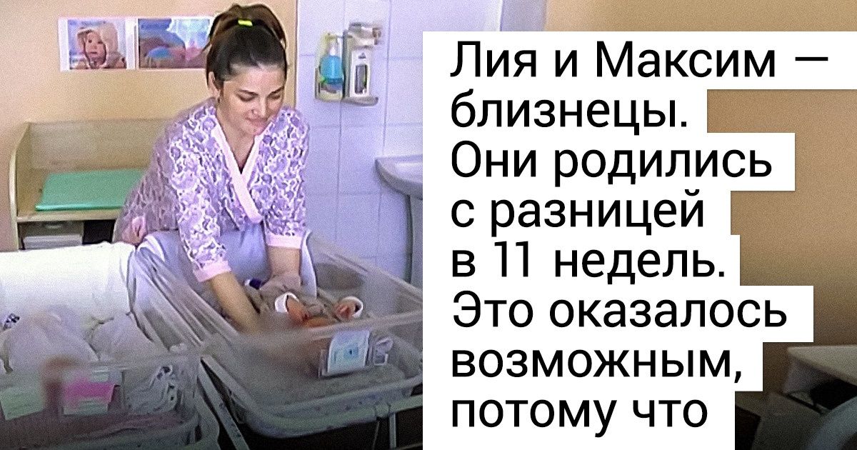 7 типов близнецов, доказывающих, что матушка-природа горазда на выдумки
