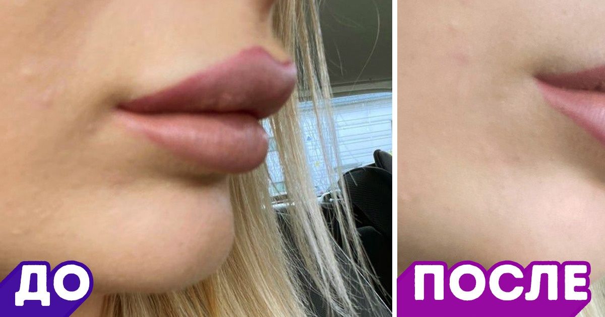 18 девушек, которые пошли на поводу у моды и попробовали себя улучшить, но потом передумали 18 девушек, которые пошли на поводу у моды и попробовали себя улучшить, но потом передумали