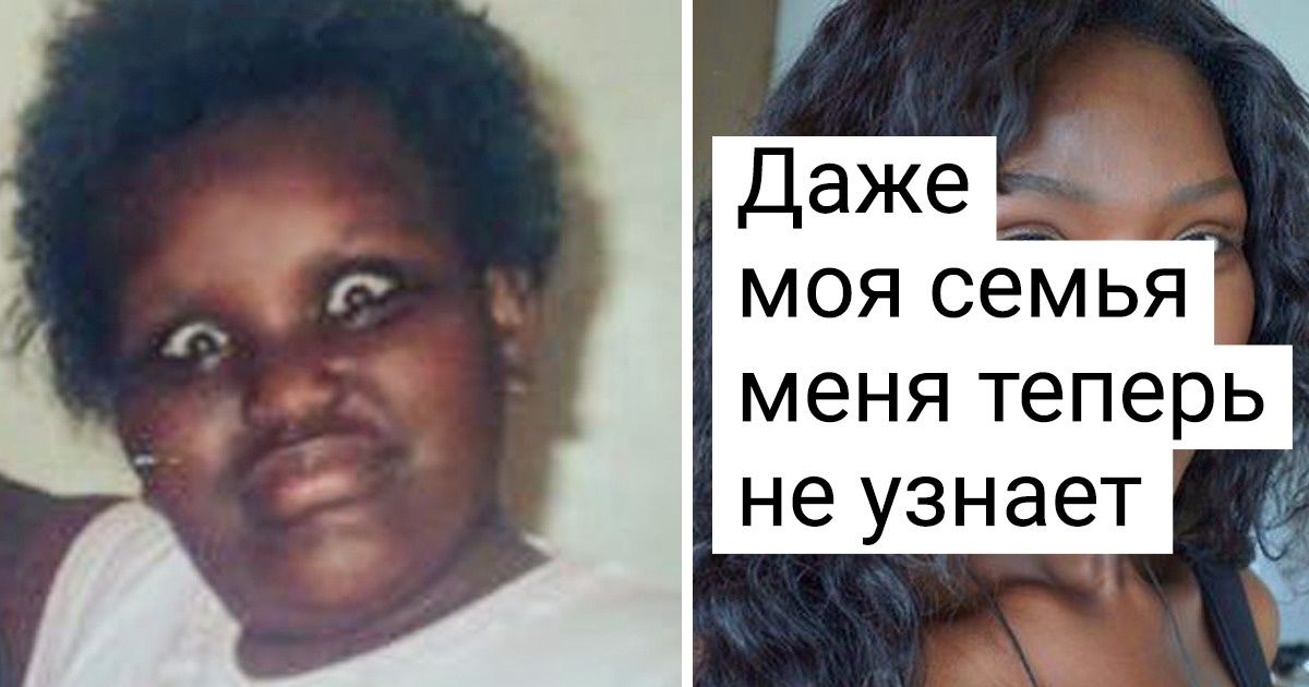 20 человек, которые были недовольны своей внешностью. Но судьба готовила для них настоящий джек-пот