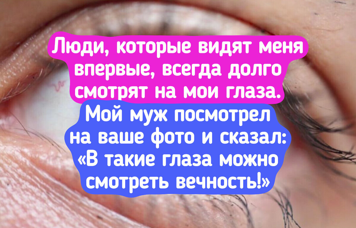 15 человек, которым природа подарила такую уникальную внешность, что от них просто невозможно оторвать взгляд 15 человек, которым природа подарила такую уникальную внешность, что от них просто невозможно оторвать взгляд