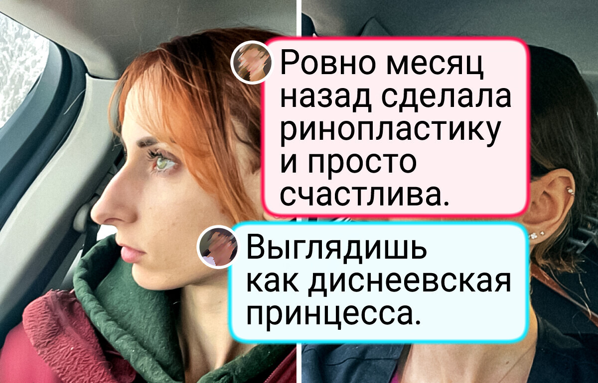 13 фото «до и после», за которыми скрывается целая история 13 фото «до и после», за которыми скрывается целая история