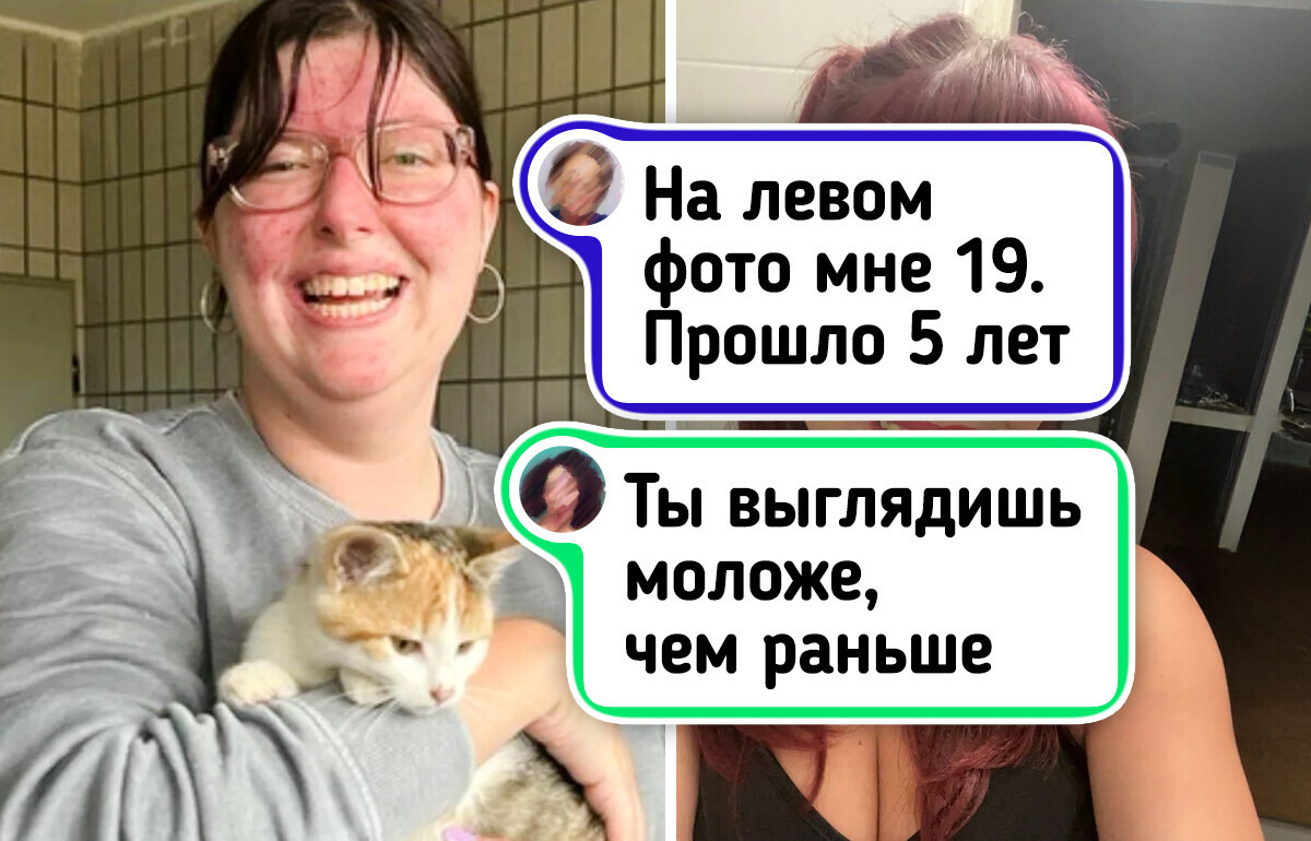 15 человек, которые изменились настолько, что даже их родные не признали бы 15 человек, которые изменились настолько, что даже их родные не признали бы