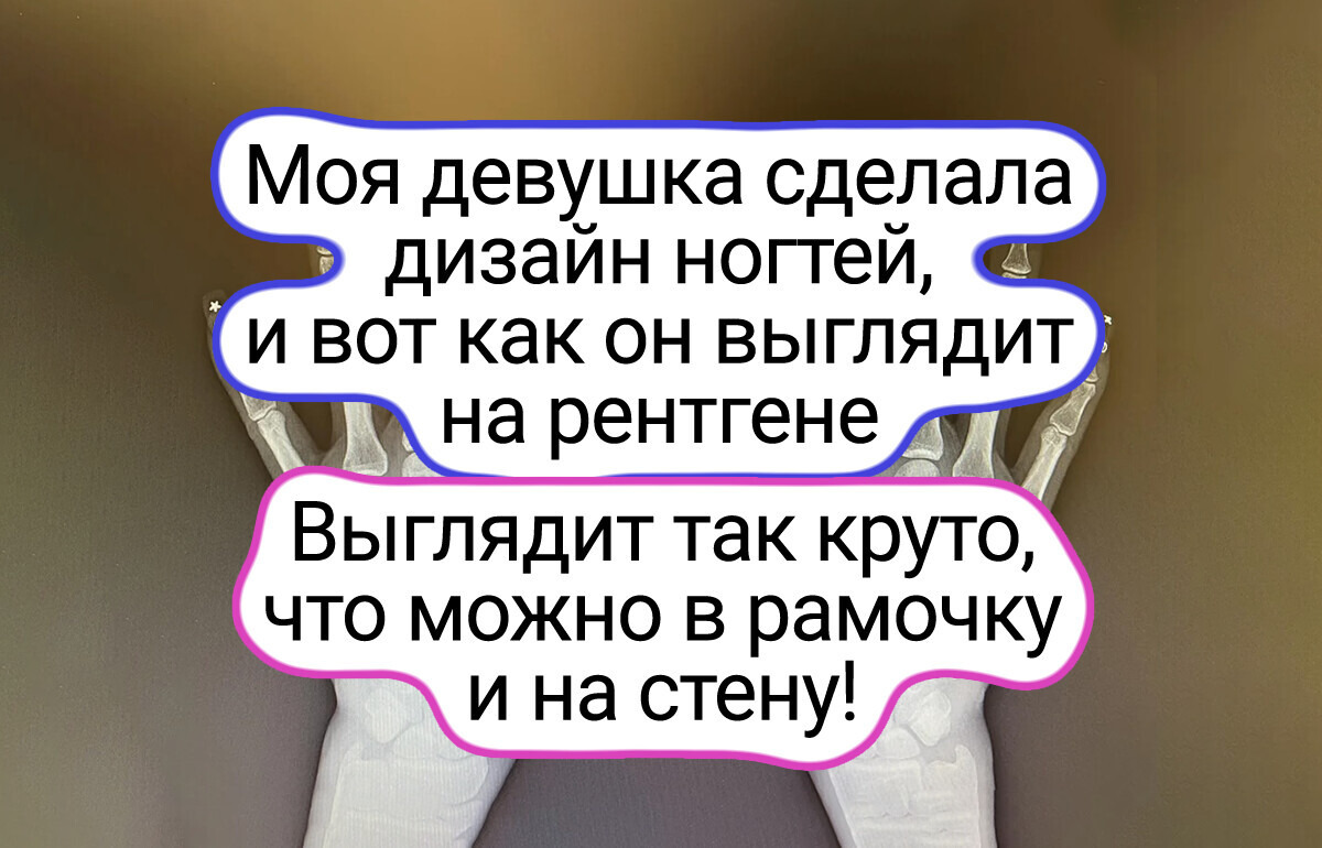 14 рентгеновских снимков, которые могут рассказать о нашем мире больше, чем мы думаем