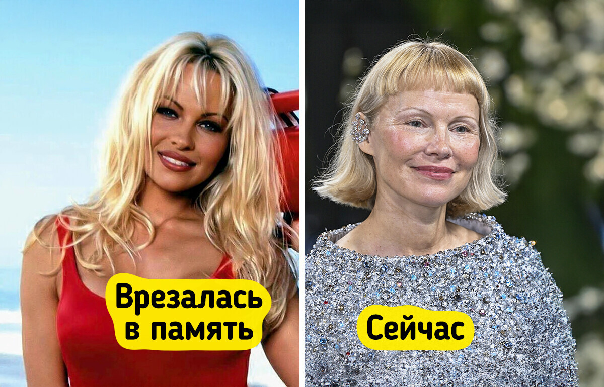 19 звезд, которые рубанули каре и стали другими людьми