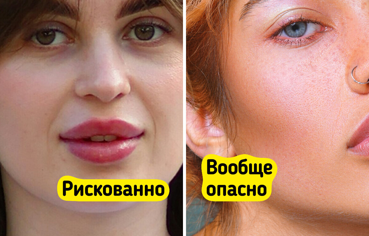 10 бьюти-процедур, которые навредить могут больше, чем радости принести 10 бьюти-процедур, которые навредить могут больше, чем радости принести