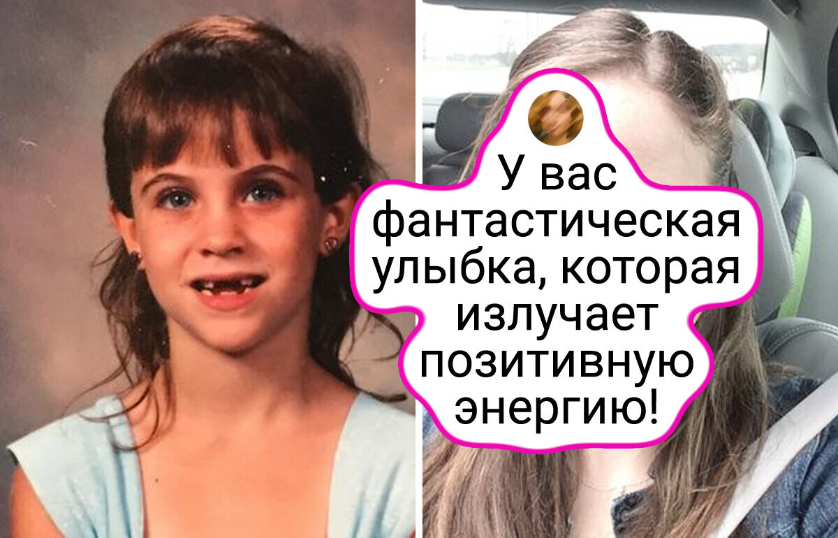 14 фото, которые заставляют воскликнуть: «Как сильно могут изменяться люди!»
