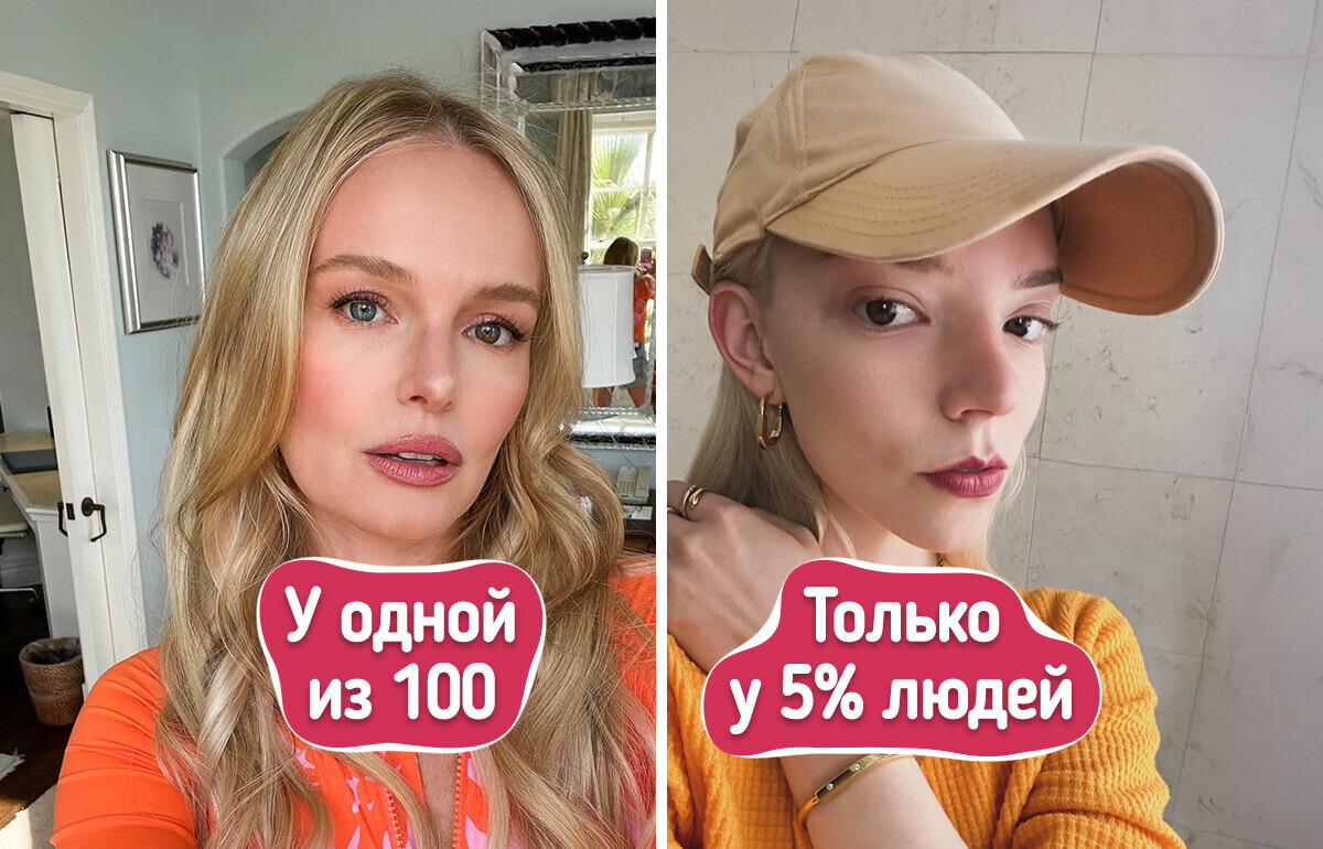 10 уникальных особенностей внешности, которыми точно стоит гордиться