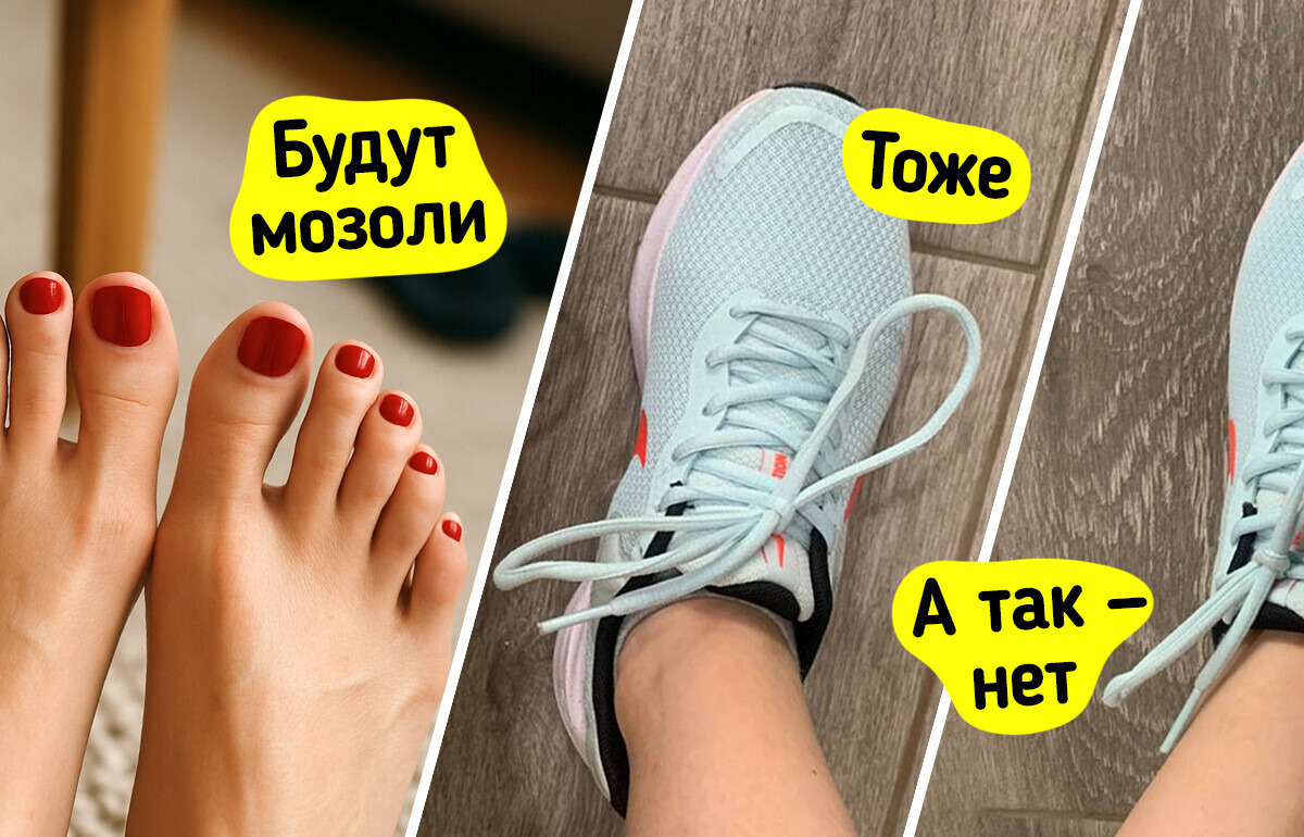 9 способов носить даже новые туфли и забыть о мозолях 9 способов носить даже новые туфли и забыть о мозолях