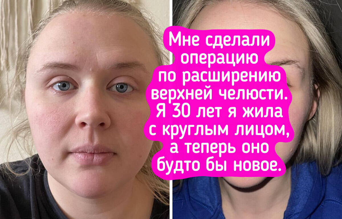 15 девушек, чьи глаза после преображения говорят громче всяких слов 15 девушек, чьи глаза после преображения говорят громче всяких слов