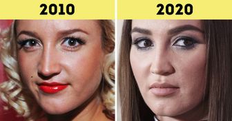 20 сравнений крупным планом, которые покажут, как с годами изменились лица наших знаменитостей
