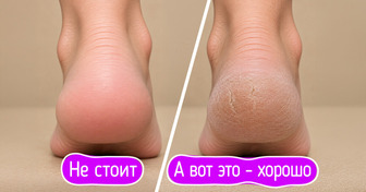9 простых идей педикюра, которые сотрут следы дачных работ быстрее, чем закипит чайник с мятой