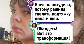14 человек, которые решились на пластику и зажили по-новому