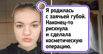 13 фото «до и после», за которыми скрывается целая история