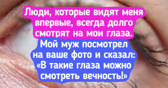 15 человек, которым природа подарила такую уникальную внешность, что от них просто невозможно оторвать взгляд