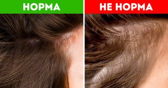 Что состояние волос может рассказать о вашем здоровье