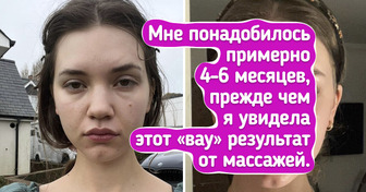 19 фотодоказательств того, что грамотный уход и процедуры меняют лицо круче, чем фотошоп