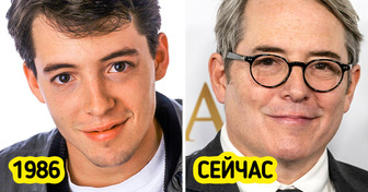 Как изменились 10 знаменитостей за десятилетия своей славы