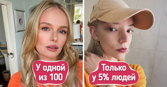 10 уникальных особенностей внешности, которыми точно стоит гордиться