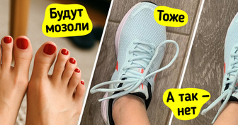 9 способов носить даже новые туфли и забыть о мозолях