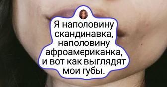15 фотографий людей с редкой внешностью, которые будто пришли с другой планеты