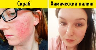 10 частых ошибок в уходе за лицом, которыми грешат почти все женщины (Спорим, парочку из них вы точно совершаете)