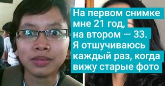 15 человек, которые считали себя гадкими утятами, но, повзрослев, поняли, насколько красивы