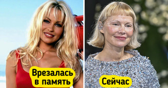 19 звезд, которые рубанули каре и стали другими людьми