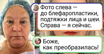 18 женщин, которые рискнули обратиться к бьюти-специалистам, показали, как изменилась их внешность