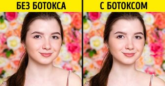 10 странных косметических процедур, на которые готовы пойти девушки ради красоты