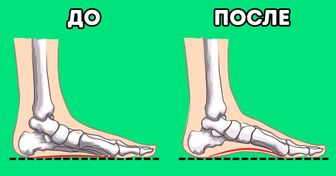 7 упражнений от ортопедов, чтобы увеличить высоту свода стопы и уменьшить боль в ногах