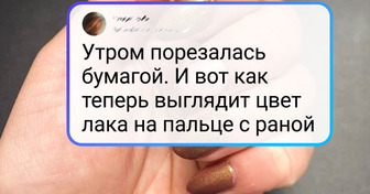 13 доказательств того, что человеческое тело способно подкинуть сюрприз