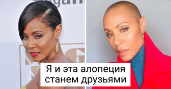 5 знаменитостей рассказали, почему они побрились налысо, и мы ими гордимся