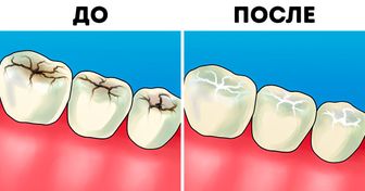 8 ответов на самые наболевшие вопросы об уходе за зубами от практикующего врача-стоматолога