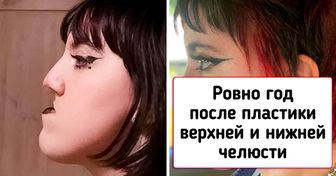 19 человек, которые однажды решились на пластическую операцию и в результате сорвали настоящий джекпот