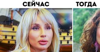 11 российских звезд, чья внешность изменилась словно по волшебству