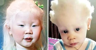 Если вы когда-нибудь задумывались, как выглядят альбиносы разных рас, то, собственно, вот так