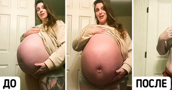Над беременной смеялись из-за огромного живота, но все изменилось, когда она родила