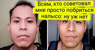 18 красавчиков, которые решили вернуть себе свои волосы