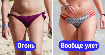 8 особенностей тела, которых многие женщины стесняются, а надо бы гордиться